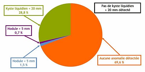 Graphique de l'IRSN:
 atteinte de la thyroide chez les enfants de Fukushima